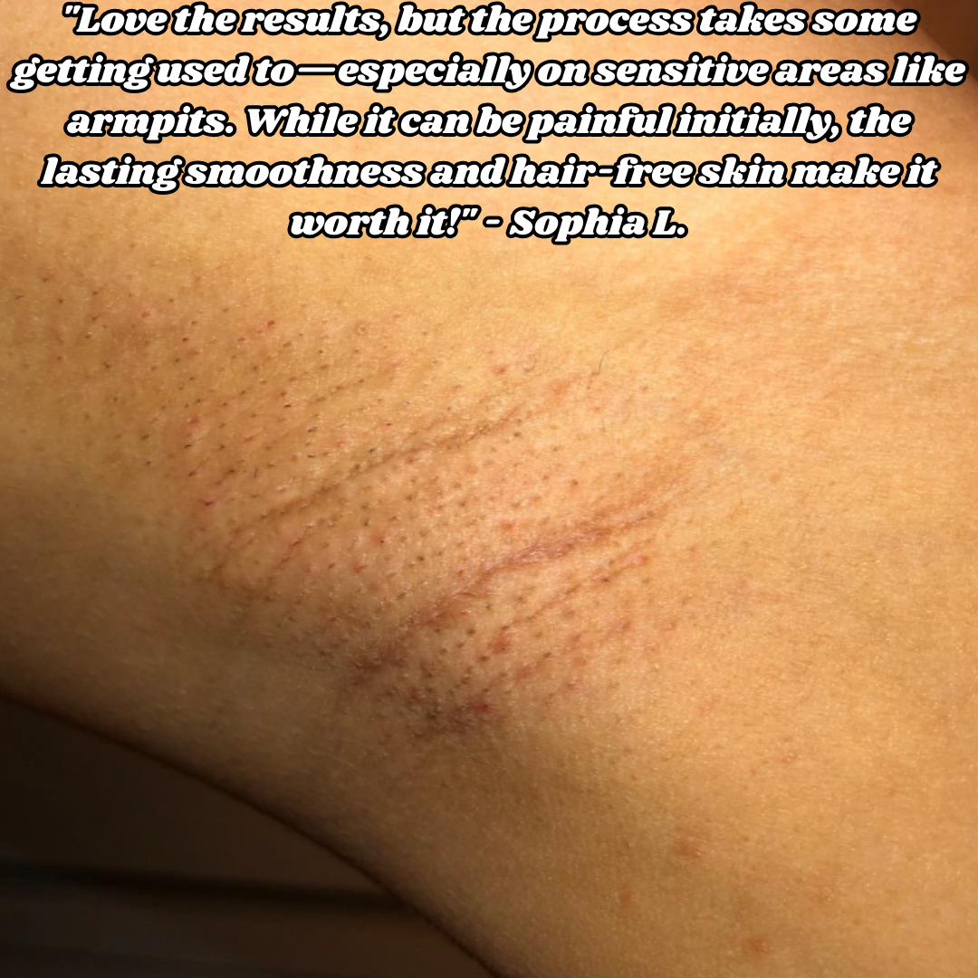 Nudera™ | Whole Body Epilator